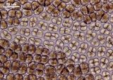 3 - Visione superficiale degli stadi iniziali di sviluppo delle spermatocisti e delle zigotospore